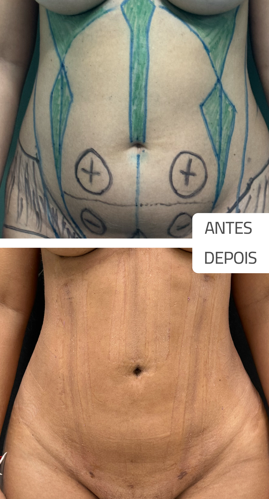 senival-antedsPrancheta-1-copiar-3