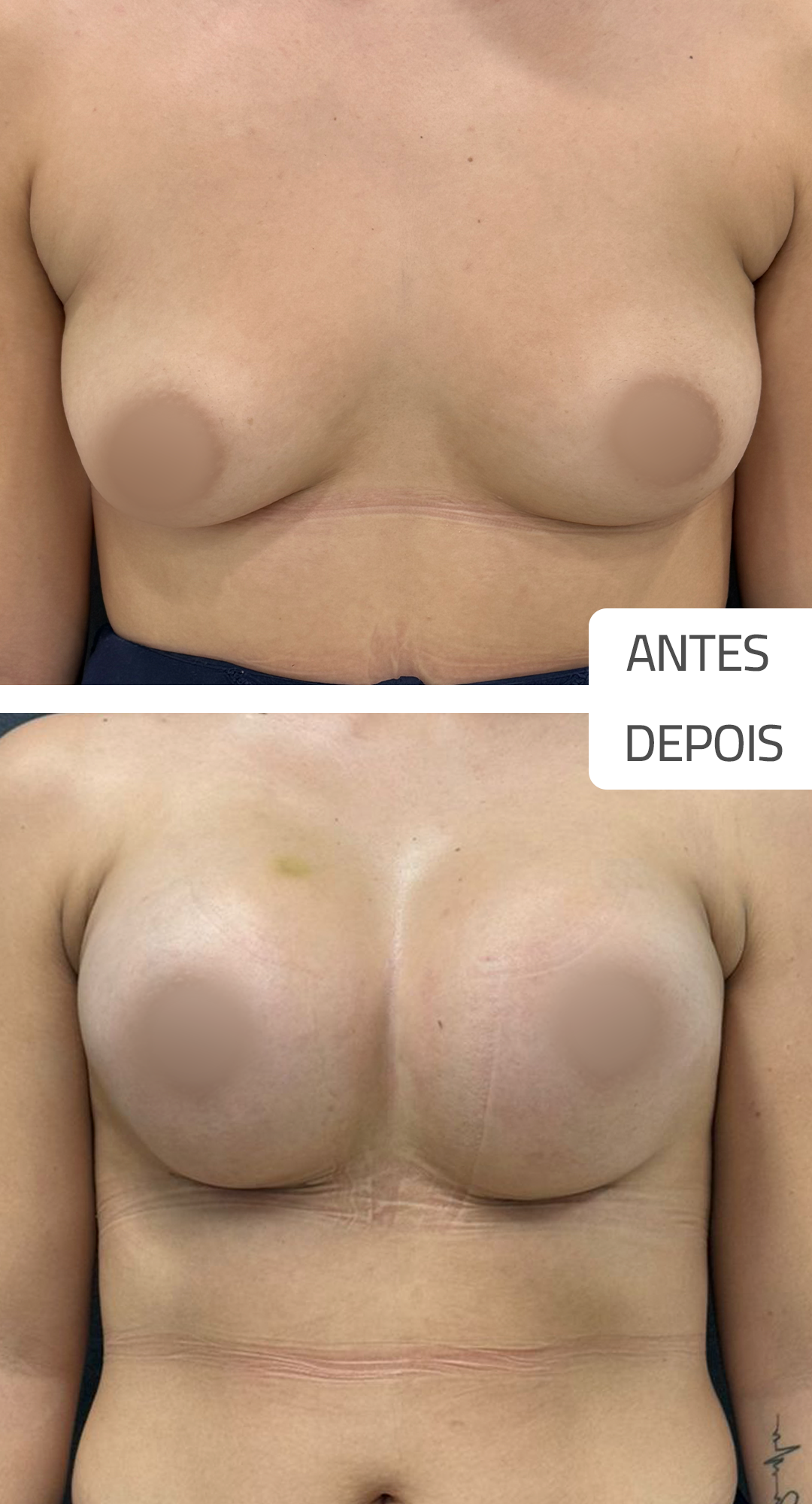 senival-antedsPrancheta-1-copiar-4