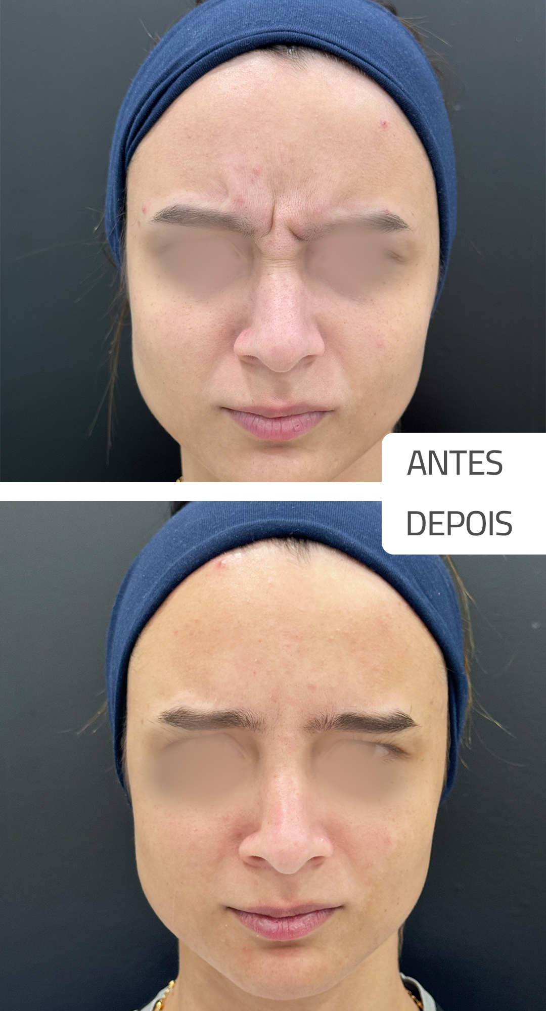 senival-antedsPrancheta-1