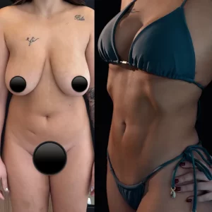 R3